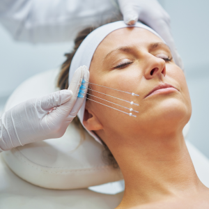 Flacidez facial