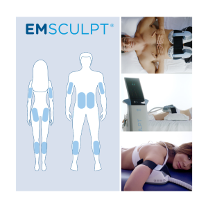 EMSCULPT Bilbao - Tratamiento de Tonificación Muscular